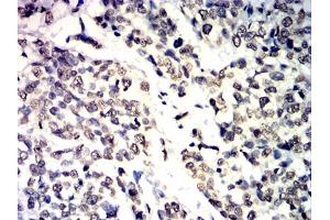 Immunohistochemistry (IHC) image for anti-Interleukin 1, beta (IL1B) (AA 117-269) antibody (ABIN7193976)