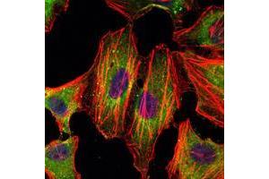 Immunofluorescence analysis of Hela cells using STAT3 mouse mAb (green). (STAT3 抗体)