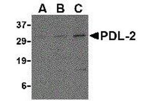 Western Blotting (WB) image for anti-Programmed Cell Death 1 Ligand 2 (PDCD1LG2) (Center) antibody (ABIN2479600) (PDCD1LG2 抗体  (Center))