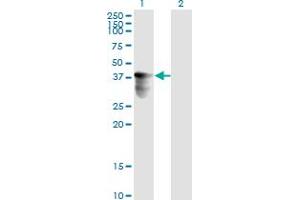 Western Blotting (WB) image for anti-Fragile Site, Folic Acid Type, Rare, Fra(10)(q23.3) Or Fra(10)(q24.2) Candidate 1 (FRA10AC1) (AA 1-100) antibody (ABIN566764)