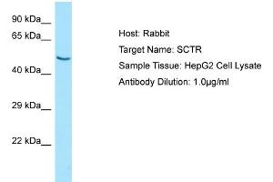 Western Blotting (WB) image for anti-Secretin Receptor (SCTR) (N-Term) antibody (ABIN2790165) (SCTR 抗体  (N-Term))