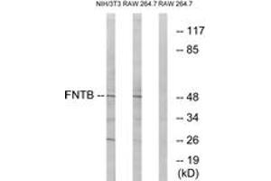Western blot analysis of extracts from RAW264. (FNTB 抗体  (AA 255-304))