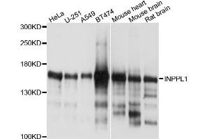 Western blot analysis of extracts of various cells, using INPPL1 antibody. (INPPL1 抗体)