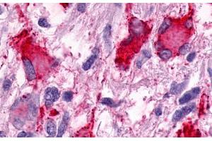 Image no. 2 for anti-G Protein-Coupled Receptor 25 (GPR25) (N-Term) antibody (ABIN1048783) (GPR25 抗体  (N-Term))