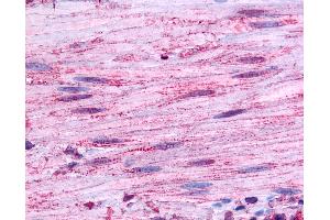 Anti-BDKRB1 antibody IHC of human smooth muscle. (BDKRB1 抗体  (Extracellular Domain))