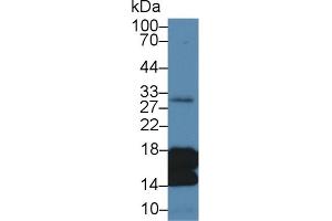 Detection of H3 in Human Liver lysate using Polyclonal Antibody to Histone H3 (H3)