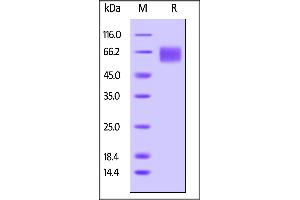 Biotinylated Human IL-6 R alpha, Avitag,His Tag on  under reducing (R) condition. (IL6RA Protein (AA 20-365) (His tag,AVI tag,Biotin))