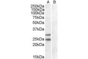 HEK293 overexpressing SOCS1 and probed with ABIN184575 (mock transfection in lane B).