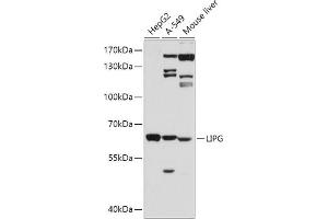 Western blot analysis of extracts of various cell lines, using LIPG antibody (ABIN3015671, ABIN3015672, ABIN3015673 and ABIN6219026) at 1:500 dilution. (LIPG 抗体  (AA 251-500))