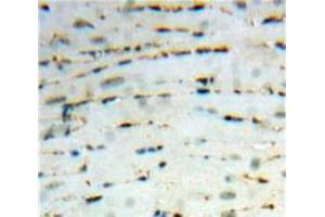 Used in DAB staining on fromalin fixed paraffin-embedded Heart tissue (CCL26 抗体  (AA 24-94))
