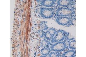 Used in DAB staining on fromalin fixed paraffin- embedded intestine tissue (WIF1 抗体  (AA 38-247))