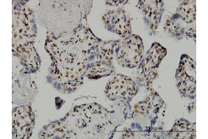 Immunostaining (ISt) image for anti-TAF7 RNA Polymerase II, TATA Box Binding Protein (TBP)-Associated Factor, 55kDa (TAF7) (AA 130-224) antibody (ABIN563086)