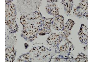 Immunoperoxidase of monoclonal antibody to TAF7 on formalin-fixed paraffin-embedded human placenta. (TAF7 抗体  (AA 130-224))