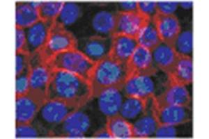 Human epidermal keratinocytes from neonatal foreskin stained in Immunofluorescence with TGM1 antibody Cat. (TGM1 抗体)