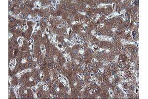 Image no. 3 for anti-DEAD (Asp-Glu-Ala-Asp) Box Polypeptide 58 (DDX58) antibody (ABIN1500708)