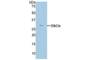 Detection of Recombinant IkBd, Human using Polyclonal Antibody to Inhibitory Subunit Of NF Kappa B Delta (IkBd) (IkBd 抗体  (AA 46-285))