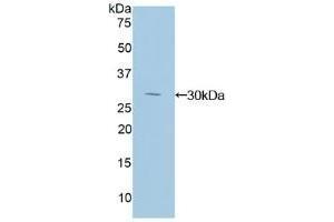 Detection of Recombinant IkBd, Human using Polyclonal Antibody to Inhibitory Subunit Of NF Kappa B Delta (IkBd)