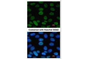 ICC/IF Image Immunofluorescence analysis of paraformaldehyde-fixed Human ESC, using SOX2, antibody at 1:100 dilution. (SOX2 抗体)