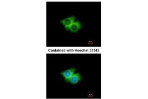 ICC/IF Image Immunofluorescence analysis of methanol-fixed Hep G2, using GPR62, antibody at 1:500 dilution. (GPR62 抗体  (N-Term))