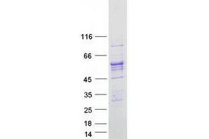 Western Blotting (WB) image for Aldehyde Dehydrogenase 1 Family, Member B1 (ALDH1B1) protein (Myc-DYKDDDDK Tag) (ABIN2714549)