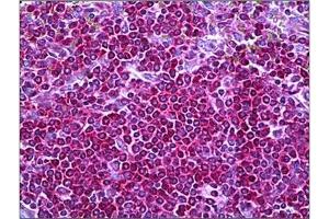 Human Spleen: Formalin-Fixed, Paraffin-Embedded (FFPE) (Neurofibromin 1 抗体  (Internal Region))