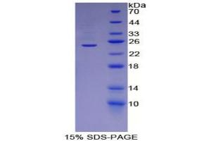 SDS-PAGE analysis of Human ADRP Protein. (ADRP 蛋白)