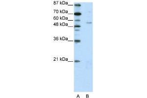 WB Suggested Anti-ZNF329 Antibody Titration:  2. (ZNF329 抗体  (N-Term))