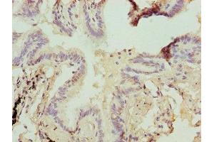 Immunohistochemistry of paraffin-embedded human lung tissue using ABIN7154897 at dilution of 1:100 (HSBP1 抗体  (AA 1-75))