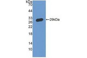 Detection of Recombinant IFNgR1, Human using Polyclonal Antibody to Interferon Gamma Receptor 1 (IFNgR1) (IFNGR1 抗体  (AA 18-245))
