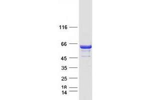 Western Blotting (WB) image for Dynein, Cytoplasmic 1, Light Intermediate Chain 1 (DYNC1LI1) protein (Myc-DYKDDDDK Tag) (ABIN2719873)
