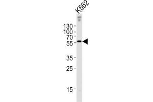 Western Blotting (WB) image for anti-Epsin 3 (EPN3) antibody (ABIN3002666) (EPN3 抗体)