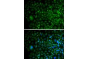 Immunofluorescence analysis of U20S cell using ANG antibody. (ANG 抗体  (AA 25-147))