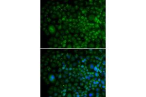 Immunofluorescence analysis of U20S cell using ANG antibody. (ANG 抗体  (AA 25-147))