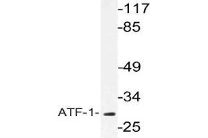 Western blot (WB) analysis of ATF-1 antibody in extracts from COLO cells. (AFT1 抗体)