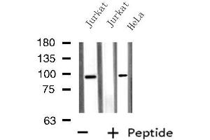 Western blot analysis of extracts from HeLa/Jurkat cells, using PTPN22 antibody. (PTPN22 抗体  (C-Term))