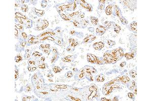 Immunohistochemistry (IHC) image for anti-Platelet/endothelial Cell Adhesion Molecule (PECAM1) (AA 28-601) antibody (ABIN7455156)