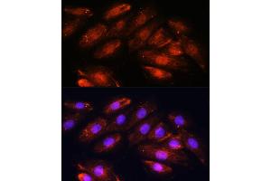 Immunofluorescence analysis of H9C2 cells using OTUB1 antibody (ABIN6128400, ABIN6145086, ABIN6145088 and ABIN6215346) at dilution of 1:100. (OTUB1 抗体  (AA 1-220))