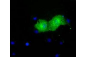 Anti-PKLR mouse monoclonal antibody (ABIN2453475) immunofluorescent staining of COS7 cells transiently transfected by pCMV6-ENTRY PKLR (RC206455). (PKLR 抗体)
