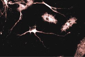 Immunofluorescent staining of Rat Neurons with anti-Adaptin gamma antibody. (gamma 1 Adaptin 抗体  (AA 642-821))