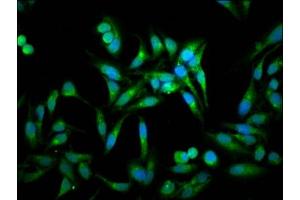 Immunofluorescence staining of Hela cells with ABIN7143230 at 1:100, counter-stained with DAPI. (ACOT1 抗体  (AA 258-350))