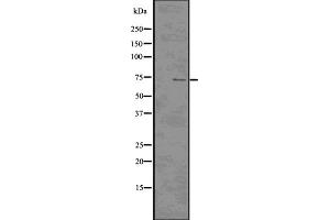 Western blot analysis of CDC7 using COLO205 whole cell lysates (CDC7 抗体  (N-Term))