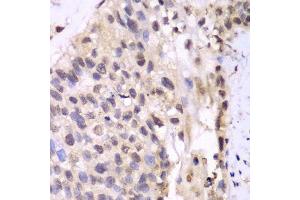 Immunohistochemistry (Paraffin-embedded Sections) (IHC (p)) image for anti-Proteasome Subunit alpha 6 (PSMA6) (AA 1-246) antibody (ABIN6146307)