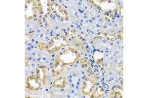 Immunohistochemistry of paraffin-embedded rat kidney using NDUFB10 antibody (ABIN5972156) at dilution of 1/100 (40x lens). (NDUFB10 抗体)