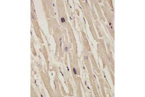 Immunohistochemistry (Paraffin-embedded Sections) (IHC (p)) image for anti-Collagen, Type XIV, alpha 1 (COL14A1) (AA 643-677) antibody (ABIN6242834)