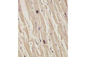 (ABIN6242834 and ABIN6578871) staining COL14A1 in human heart tissue sections by Immunohistochemistry (IHC-P - paraformaldehyde-fixed, paraffin-embedded sections). (COL14A1 抗体  (AA 643-677))