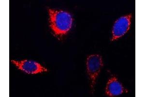 IF analysis of PITRM1 using anti-PITRM1 antibody (ABIN7601336). (PITRM1 抗体  (AA 33-1037))