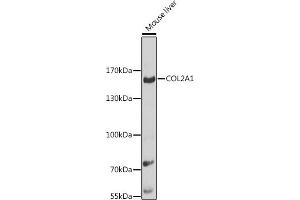 Western blot analysis of extracts of mouse liver, using COL2 antibody (560) at 1:1000 dilution. (COL2A1 抗体  (AA 873-1072))