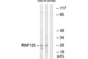 Western blot analysis of extracts from K562/HT-29 cells, using RNF125 Antibody. (RNF125 抗体  (AA 131-180))