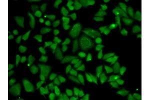 Immunofluorescence analysis of A549 cells using ALDH2 antibody. (ALDH2 抗体)