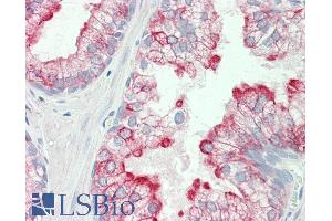 ABIN5539537 (5µg/ml) staining of paraffin embedded Human Prostate. (HRH3 抗体  (Internal Region))